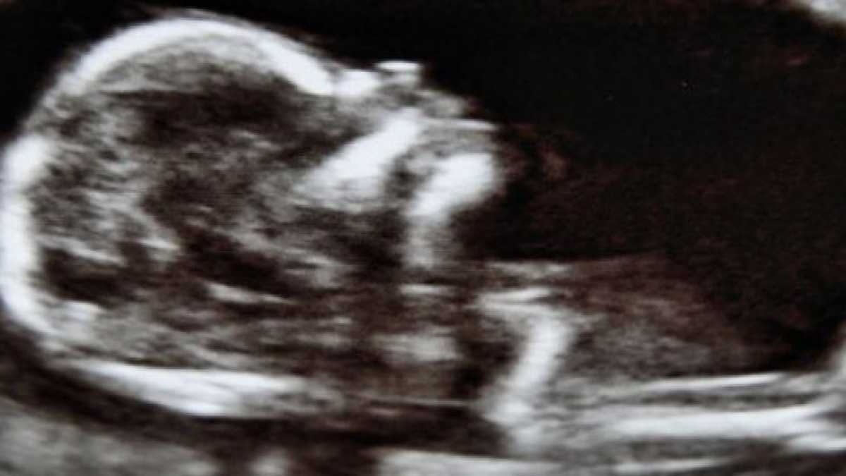Immagine di L'armata catto-fantasma che affondò l'aborto. Appunti