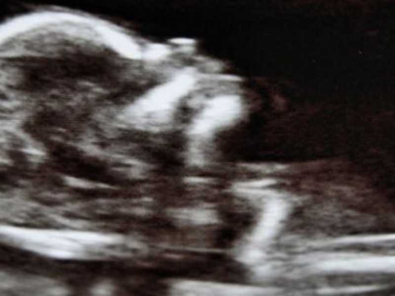 L'armata catto-fantasma che affondò l'aborto. Appunti