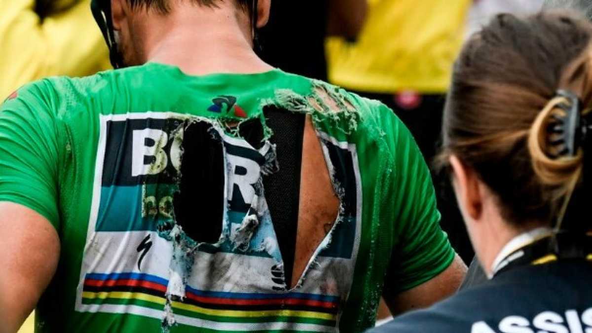 Immagine di Sagan, Gilbert e la scorza dura dei ciclisti