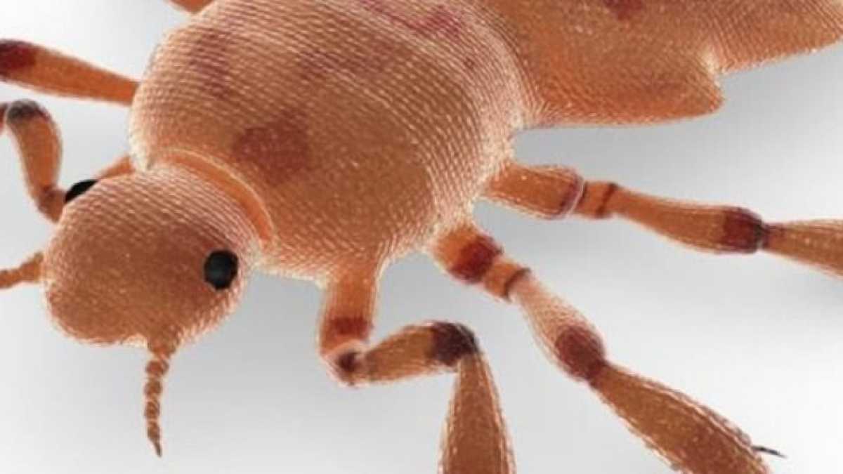 Immagine di Falsi miti sui pidocchi