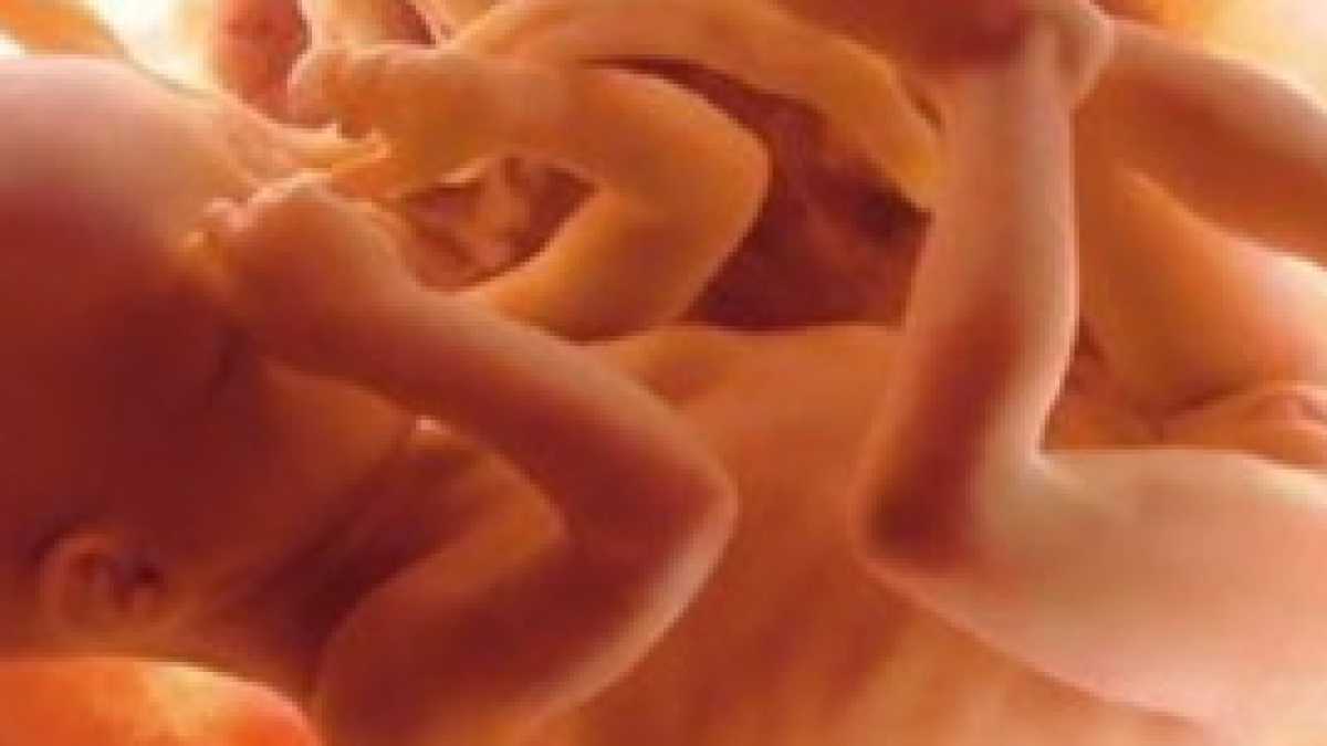 Immagine di Sopprimere i bambini non è la cura