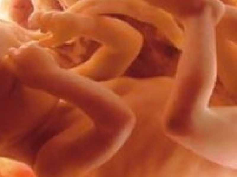 Sopprimere i bambini non è la cura