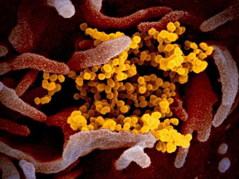 Una fotografia al microscopio elettronico del virus (in giallo) tra cellule umane (NIAID-RML&copy;)