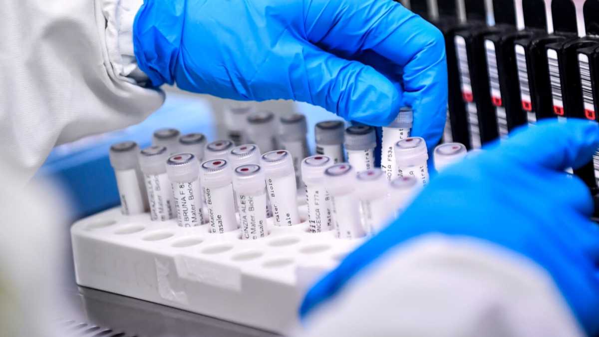 Immagine di Bisogna aumentare i test. E i laboratori di ricerca si mettono a disposizione
