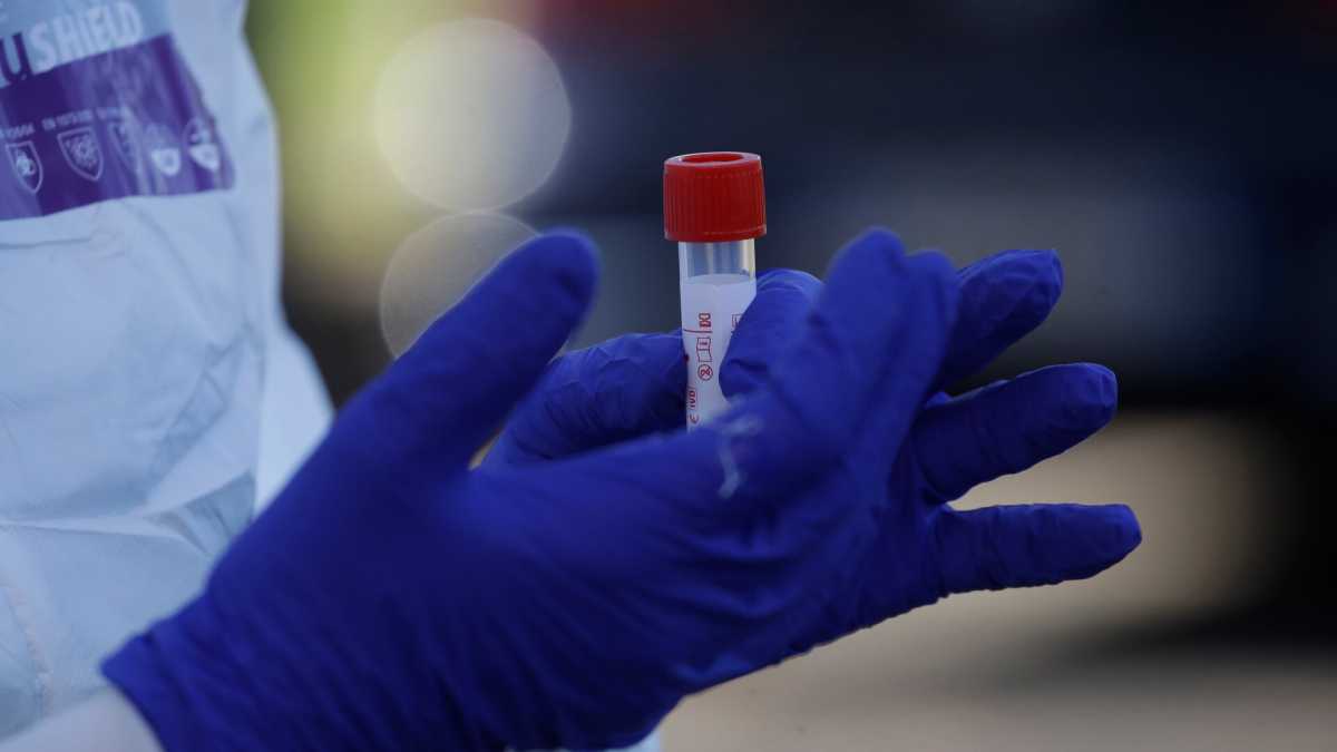 Immagine di L'eccellenza italiana che fa i test per il virus in un'ora