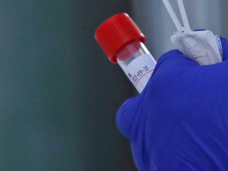 (foto LaPresse)