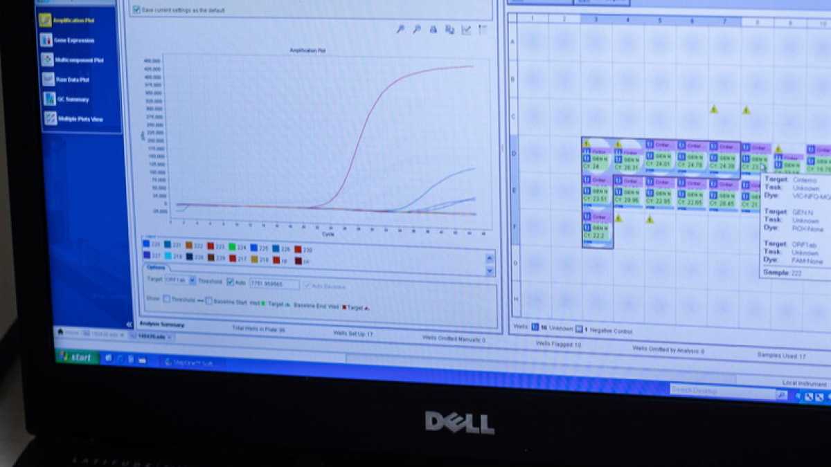 Immagine di Così si formano gli eserciti di “contact tracer”, i detective del coronavirus
