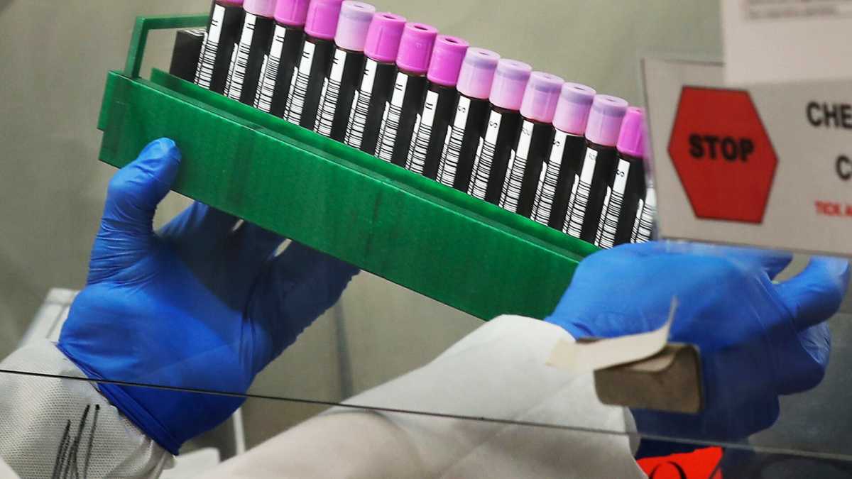 Immagine di Il caso Ioannidis, l’epidemiologo contrarian, e il rischio di una scienza avviata al pensiero unico