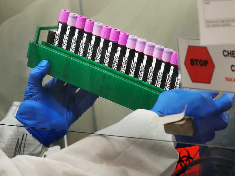 Il caso Ioannidis, l’epidemiologo contrarian, e il rischio di una scienza avviata al pensiero unico