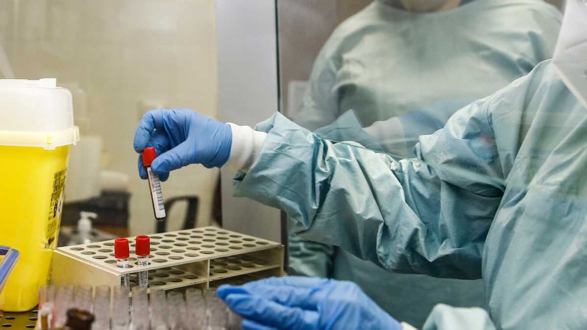 Immagine di Confusione sui test sierologici privati: quanto costano e a che servono