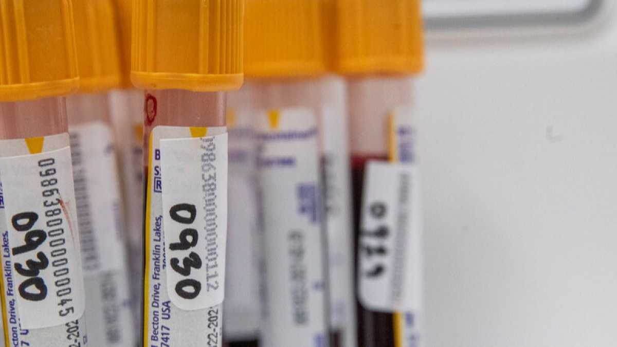 Immagine di Arrivano i primi risultati dei test sierologici e tra i grillini tornano i No vax