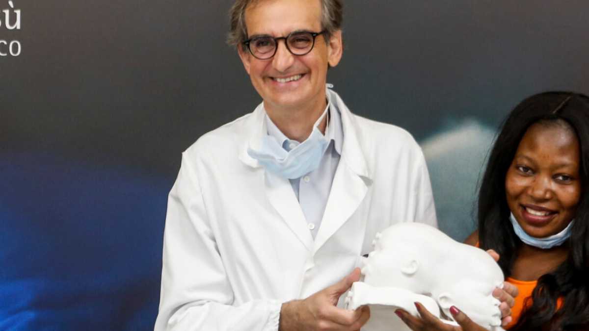 Immagine di Le gemelline siamesi operate alla testa che resteranno comunque unite per sempre