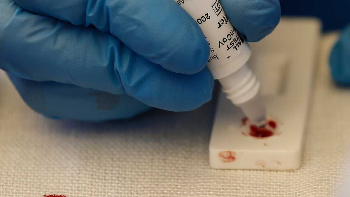 Immagine di Il coronavirus e l'esigenza di diagnosi rapide