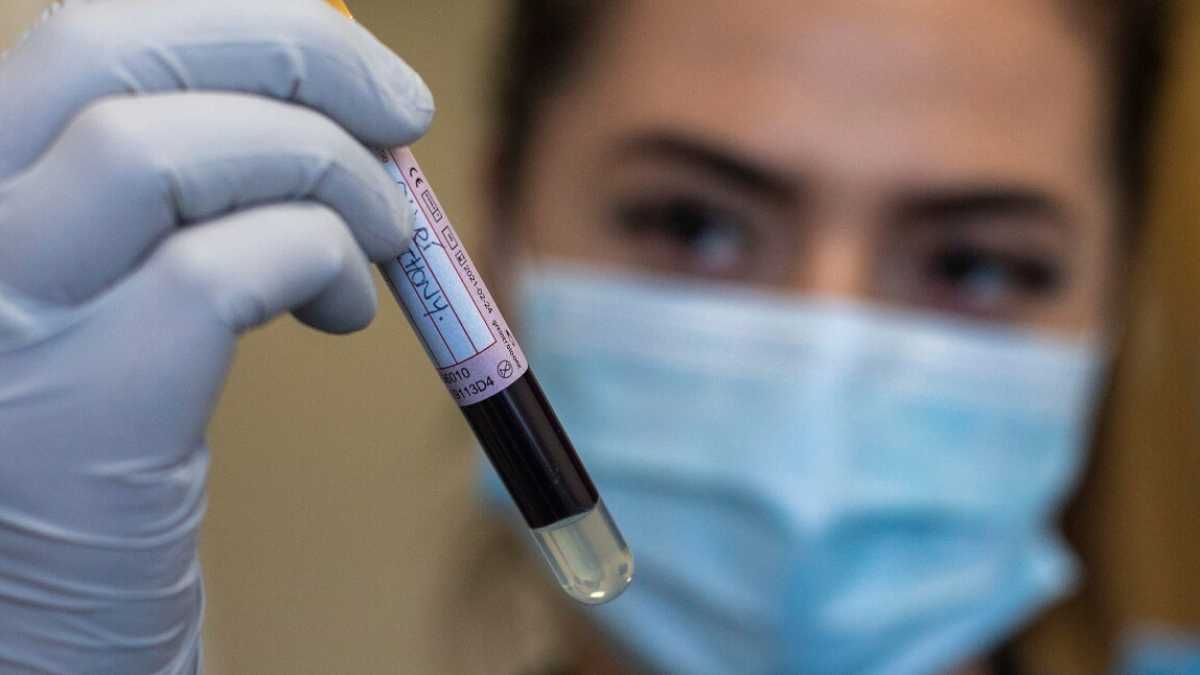 Immagine di Uno studio di Nature dice che l'immunità di gregge dal Covid-19 potrebbe essere più vicina