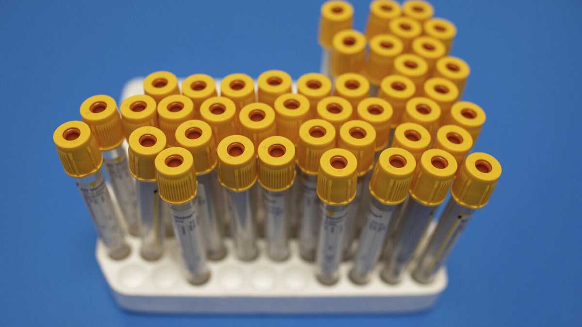 Immagine di Chi si fida più dell’Oms?