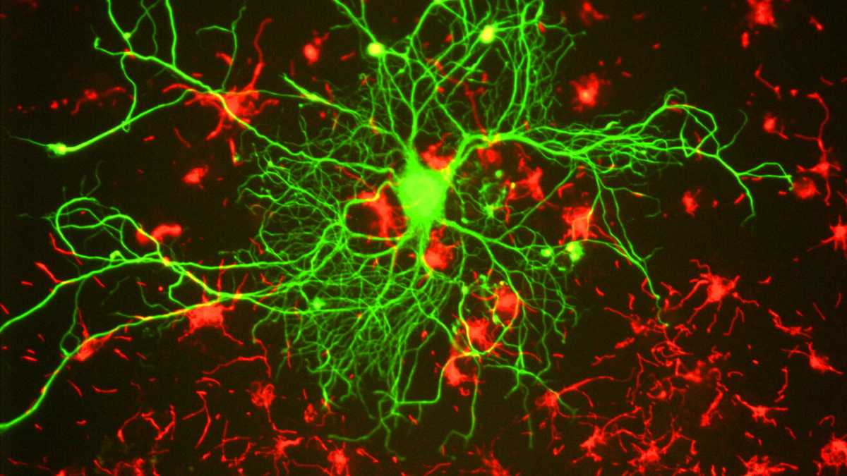 Immagine di Ecco lo studio che rivoluzionerà le nostre certezze sul sistema nervoso. E aiuterà a evitare gli psicofarmaci