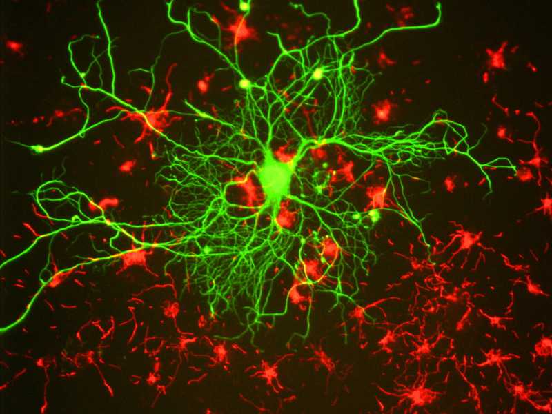Neuroni in un tessuto coltivato in vitro (foto Wikimedia)