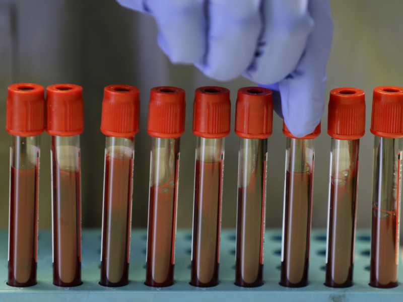 Vaccini, dubbi e dati misteriosi. Occorre fare chiarezza