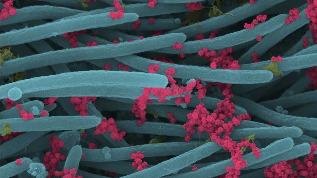 Immagine di Non c’è un virus buono