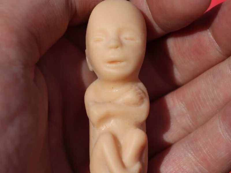 “Siamo per la biodiversità e la protezione della natura, ma i bambini abortiti neanche li vediamo”