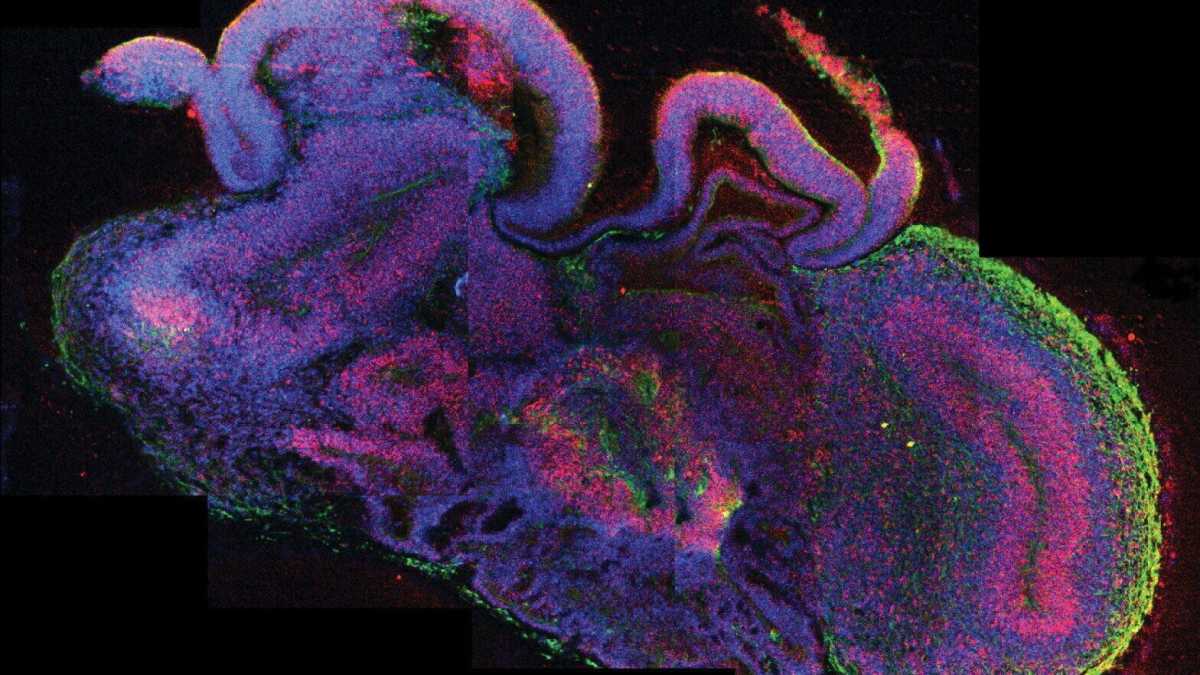 Immagine di Sugli organoidi cerebrali è necessaria una profonda riflessione etica