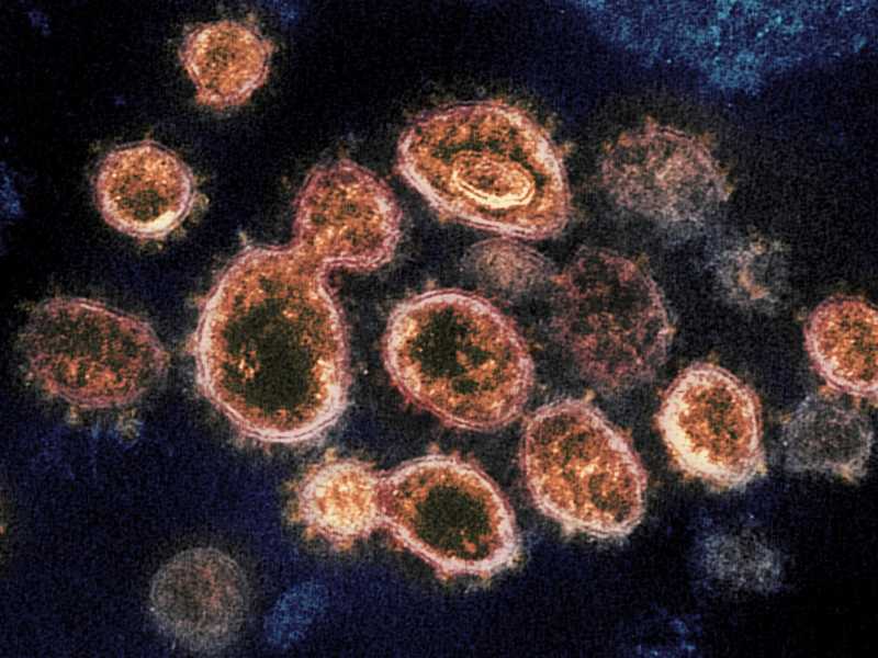 Immagine del virus SARS-CoV-2 al microscopio elettronico (National Institute of Allergy and Infectious Diseases - Rocky Mountain Laboratories via AP) <br />