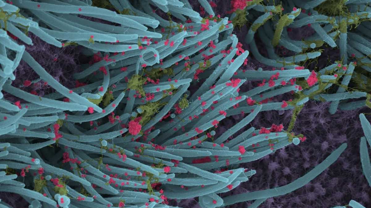 Immagine di Basta con la storia del virus buono: la natura ha le zanne