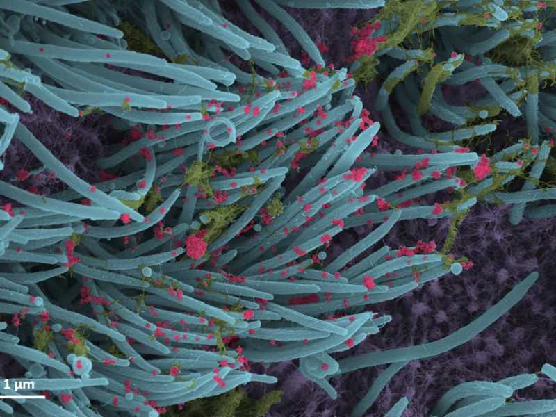 Struttura e densità delle particelle del virus SarsCoV2 (in rosso) nelle cellule umane (in blu) che rivestono i bronchi, 14 settembre 2020. ANSA / Ehre Lab, UNC School of Medicine