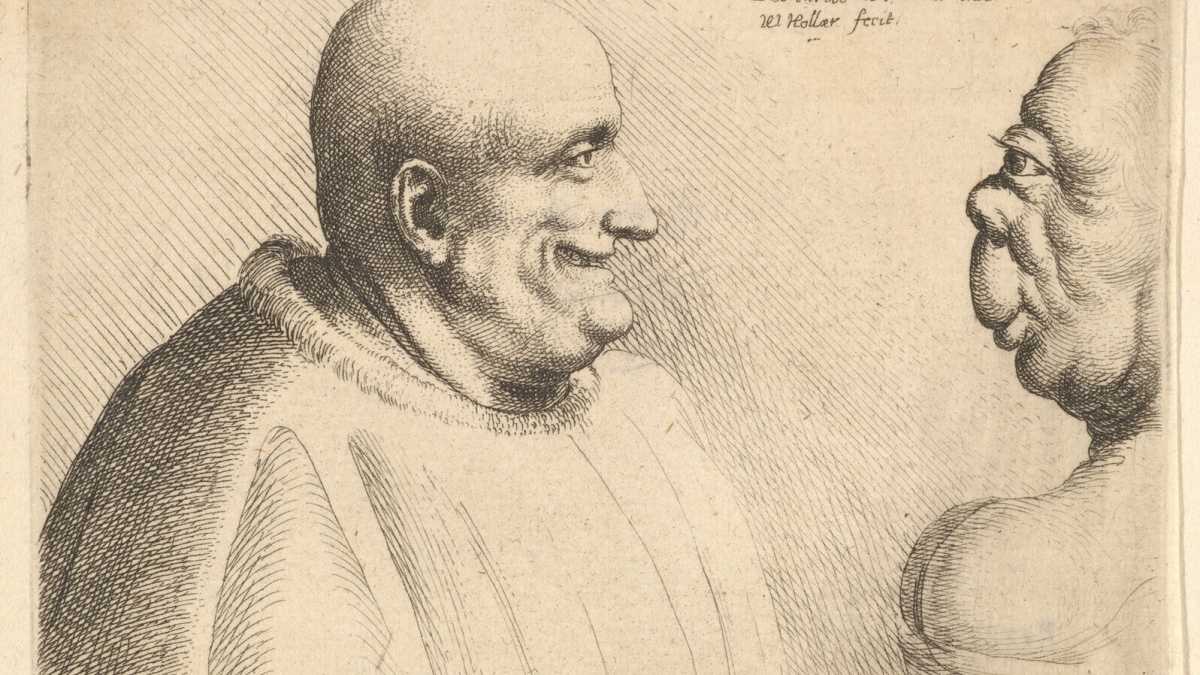 Immagine di Le tre forme di cretinismo secondo Lombroso