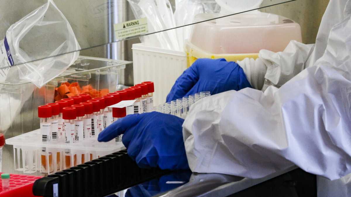 Immagine di Un vaccino contro tutte le varianti grazie a un nuovo anticorpo monoclonale