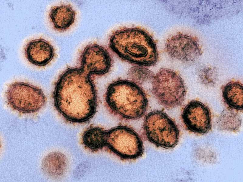 È troppo presto per avere paura di Omicron, la variante sudafricana