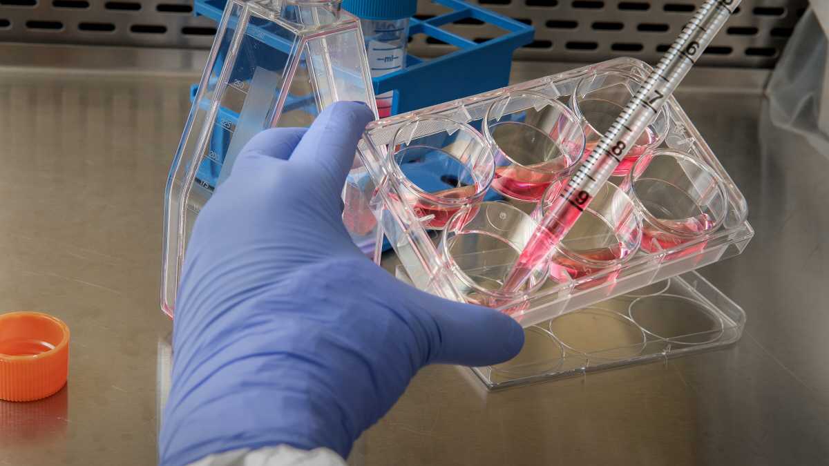 Immagine di La presunta variante Deltacron, o come la scienza sa correggersi