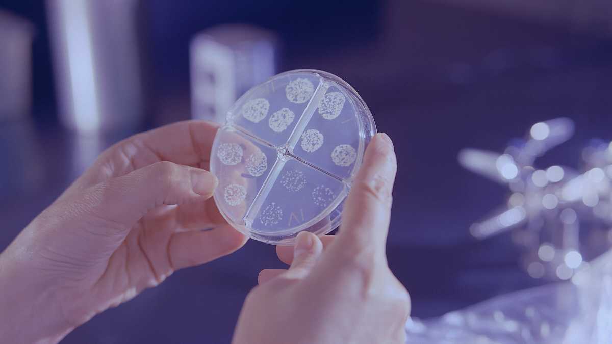 Immagine di I batteri sono sempre un passo avanti agli antibiotici. Rischi futuri