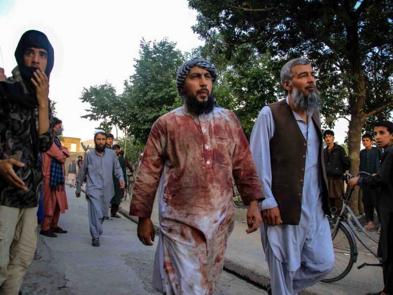 Un sopravvissuto all'esplosione alla moschea di Kabul venerd&igrave; scorso, con i vestiti ancora sporchi di sangue (foto LaPresse)