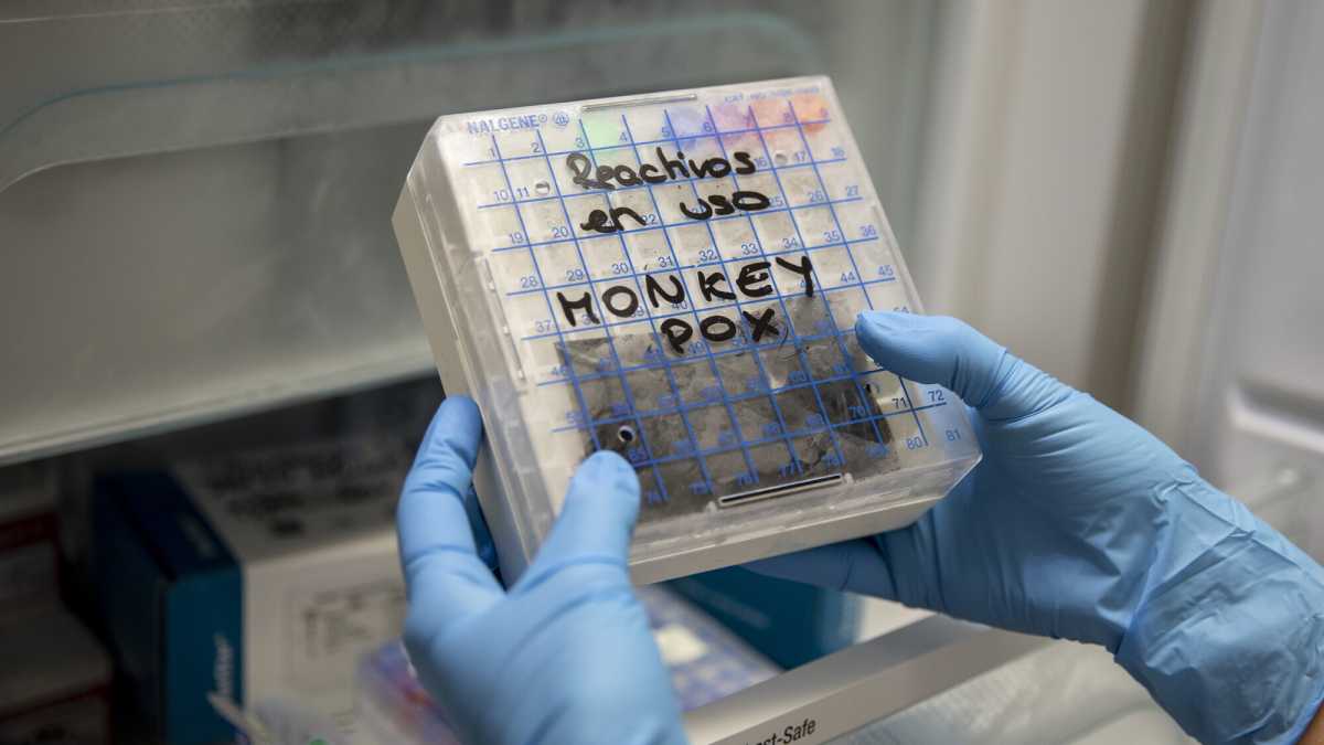 Immagine di Ecco cosa serve per tenere sotto controllo l'epidemia di vaiolo delle scimmie