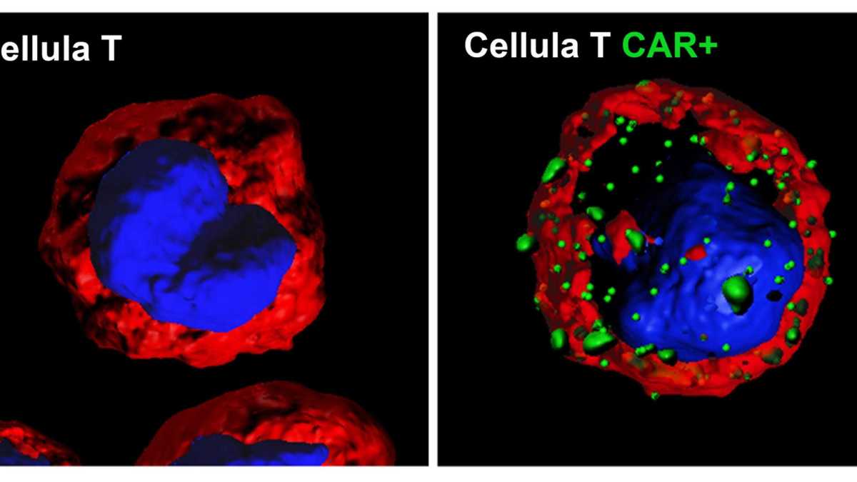 Immagine di Il "linguaggio molecolare" che dice alle cellule: "Distruggi il cancro"