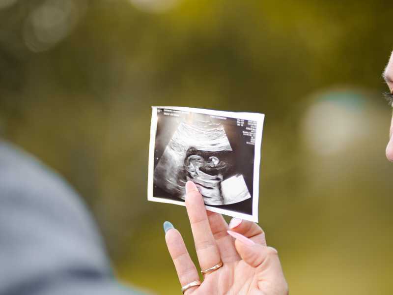 Caro Giuliano, il così detto utero in affitto è un tema che c’entra poco con l’amore omogenitoriale