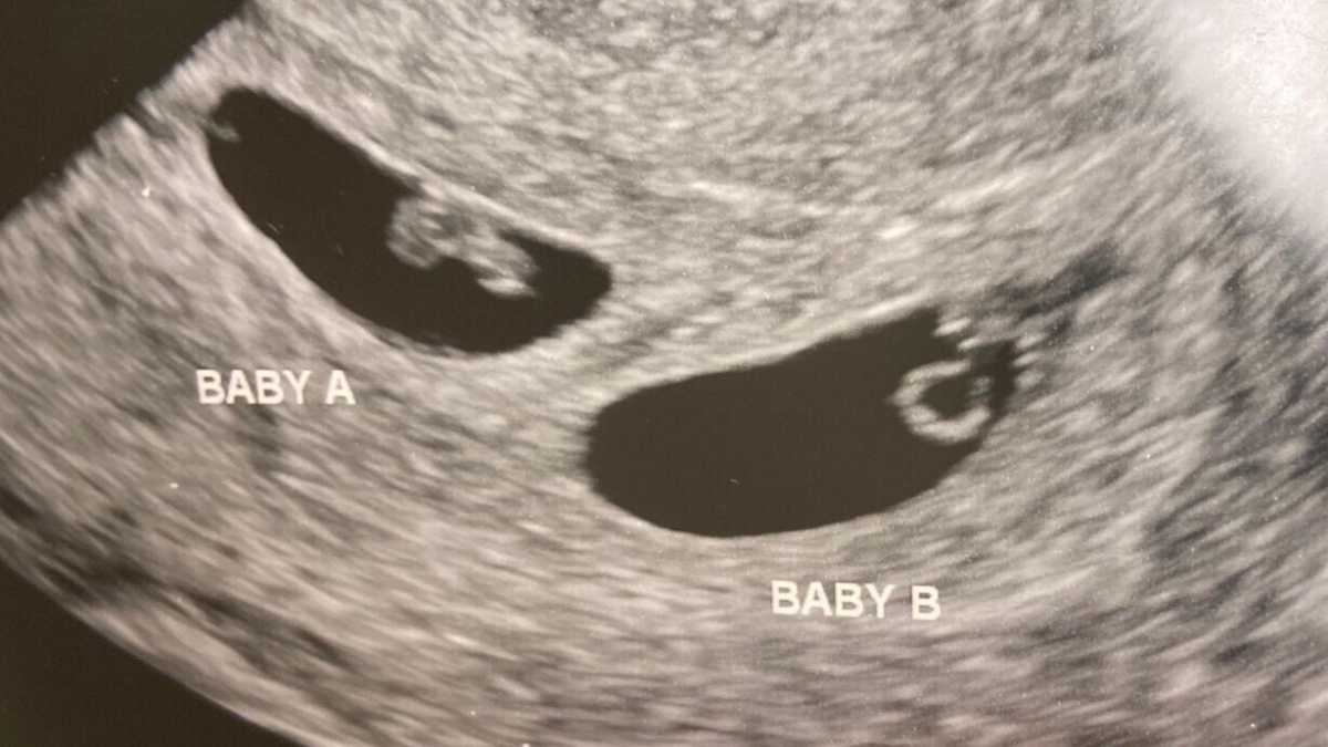 Immagine di Ci stupiamo per l'embrione sintetico. Ma era tutto già previsto