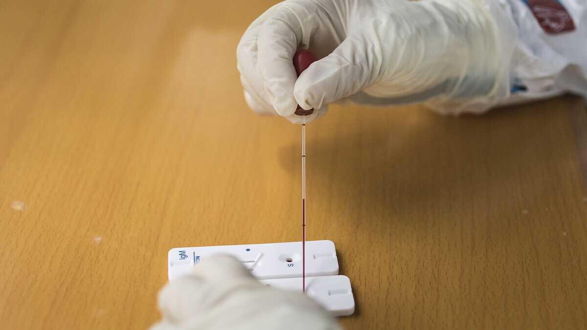 Immagine di Dietro al Covid non c’era un laboratorio, ma soltanto la natura. Un nuovo studio