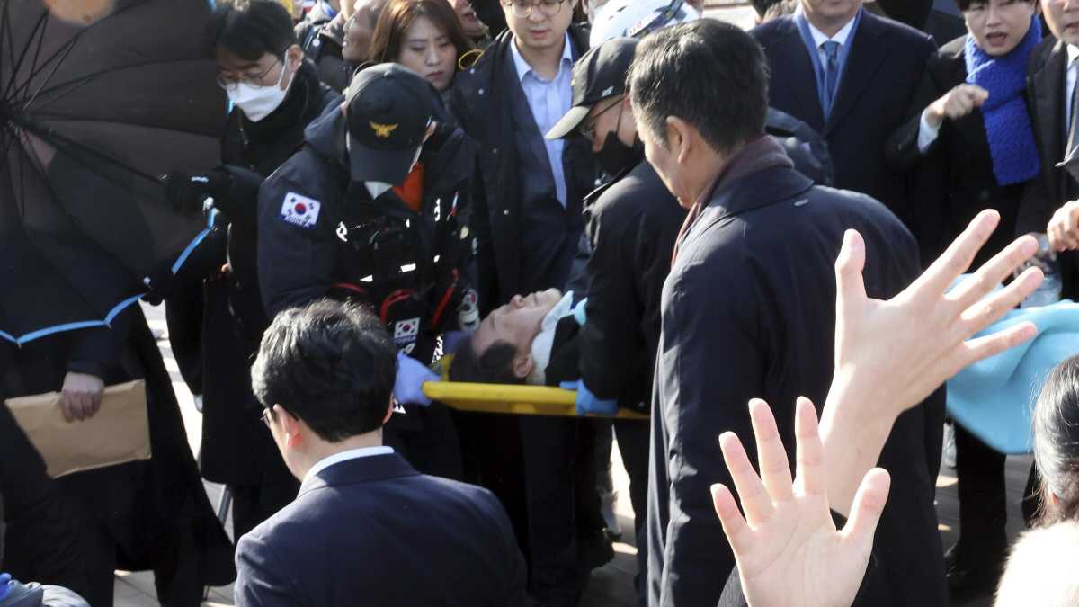 Immagine di Attentato a Busan, accoltellato il leader della sinistra coreana