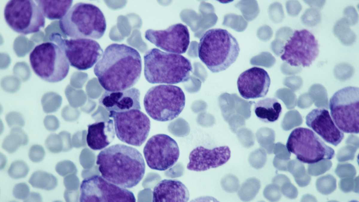 Immagine di Cancro senza mutazioni: il ruolo nascosto delle modifiche epigenetiche
