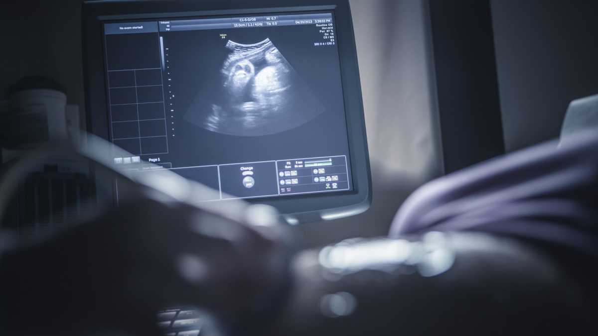 Immagine di Ecco qual è il vero costo di essere madri