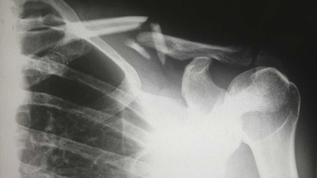 Immagine di Il dolore fisico, un problema di genere
