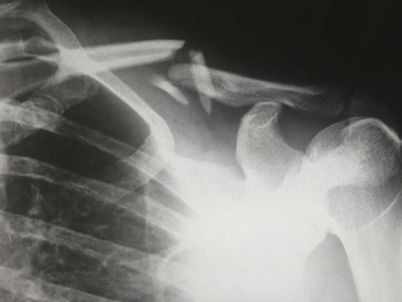 Il dolore fisico, un problema di genere