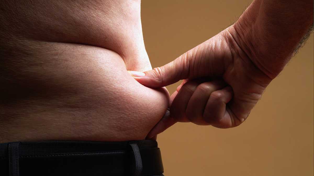 Immagine di L'obesità a 17 anni ha una forte trasmissibilità familiare