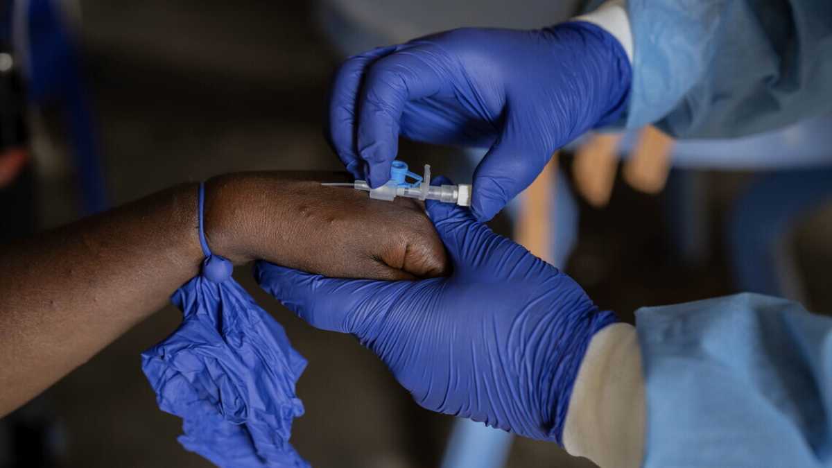 Immagine di Il nuovo virus Mpox e la strada per far arrivare i vaccini dove servono