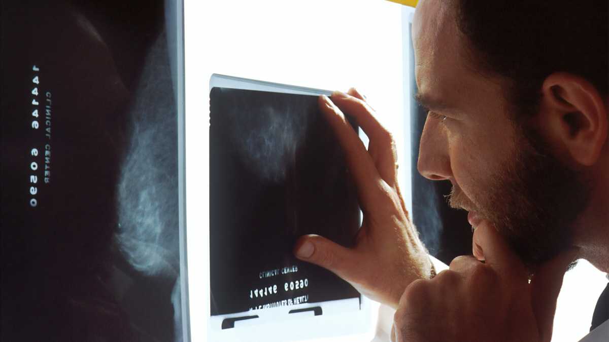 Immagine di Buone notizie sullo screening