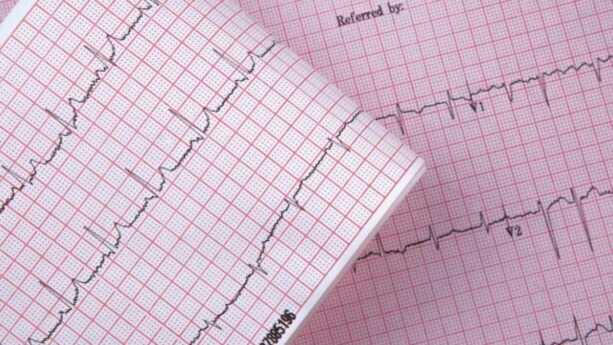Immagine di Cosa accade quando un'ipotesi di lavoro scientifico entra nella centrifuga dei social