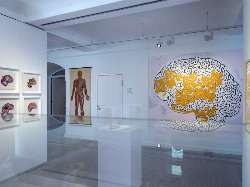 Charit&eacute; Medical History Museum di Berlino (Getty)&nbsp;<br />
