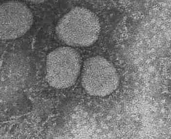 Fonte: dipartimento di microbiologia, universit&agrave; di Hong Kong e unit&agrave; governativa dei virus, dipartimento della Sanit&agrave;, Hong Kong SAR Cina